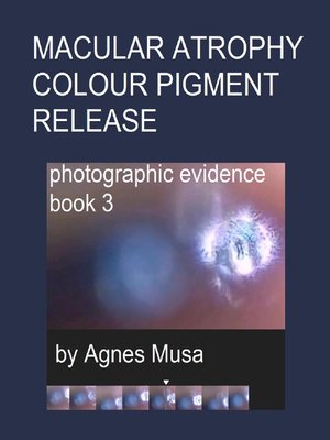 cover image of Macular Atrophy Colour Pigment Release, Photographic Evidence Book 3